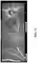 Fig. 04 - Methods for treating and diagnosing blinding eye diseases
