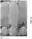 Fig. 09 - Methods for treating and diagnosing blinding eye diseases
