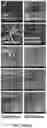 Fig. 16 - Methods for treating and diagnosing blinding eye diseases