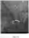 Fig. 19 - Methods for treating and diagnosing blinding eye diseases