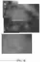 Fig. 20 - Methods for treating and diagnosing blinding eye diseases