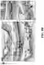 Fig. 22 - Methods for treating and diagnosing blinding eye diseases