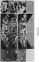 Fig. 29 - Methods for treating and diagnosing blinding eye diseases