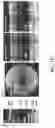 Fig. 30 - Methods for treating and diagnosing blinding eye diseases