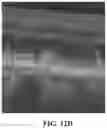 Fig. 33 - Methods for treating and diagnosing blinding eye diseases