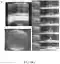 Fig. 34 - Methods for treating and diagnosing blinding eye diseases