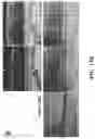 Fig. 35 - Methods for treating and diagnosing blinding eye diseases