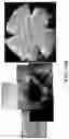 Fig. 37 - Methods for treating and diagnosing blinding eye diseases