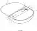 Fig. 03 - CELL SUSPENSION AND USE THEREOF