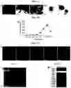 Fig. 02 - Generation of lung bud organoids with branching structures and uses thereof for lung disease modeling