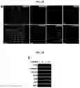 Fig. 04 - Generation of lung bud organoids with branching structures and uses thereof for lung disease modeling