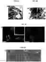 Fig. 08 - Generation of lung bud organoids with branching structures and uses thereof for lung disease modeling