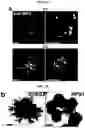 Fig. 11 - Generation of lung bud organoids with branching structures and uses thereof for lung disease modeling