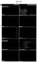 Fig. 13 - Generation of lung bud organoids with branching structures and uses thereof for lung disease modeling