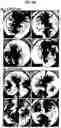 Fig. 20 - Generation of lung bud organoids with branching structures and uses thereof for lung disease modeling