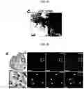 Fig. 24 - Generation of lung bud organoids with branching structures and uses thereof for lung disease modeling