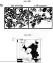 Fig. 30 - Generation of lung bud organoids with branching structures and uses thereof for lung disease modeling