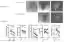 Fig. 13 - METHODS AND MATERIALS FOR TREATING FISTULAS