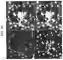 Fig. 07 - Method for regenerating the interverterbral disc with notochordal cells