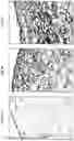 Fig. 09 - SYSTEMS FOR CARTILAGE REPAIR