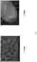 Fig. 10 - Dynamic bioactive bone graft material having an engineered porosity