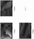 Fig. 11 - Dynamic bioactive bone graft material having an engineered porosity