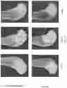 Fig. 14 - Dynamic bioactive bone graft material having an engineered porosity