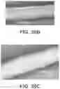 Fig. 17 - High strength biomedical materials