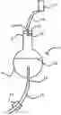Fig. 01 - Drip chamber assembly that functions irrespective of orientation