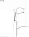 Fig. 06 - Drip chamber assembly that functions irrespective of orientation