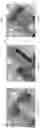 Fig. 09 - Device for subcutaneous delivery of fluid medicament
