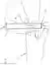 Fig. 23 - Injection spring for aged prefilled syringe and auto injector