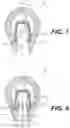 Fig. 06 - Needle shield grip devices and related methods