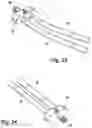 Fig. 16 - Multi-modal five lumen gas circulation system for use in endoscopic surgical procedures