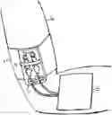 Fig. 01 - Padded Forearm Band To Secure Peripherally Inserted Central Catheter (PICC) Lumens, Eden Melmed, US, Spring Lake, NJ