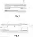 Fig. 02 - Balloon catheter with adjustable inner member