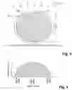Fig. 03 - Balloon catheter with adjustable inner member