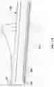 Fig. 25 - Multimodal endoscope and methods of use