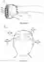 Fig. 06 - System for electrical stimulation