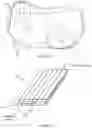 Fig. 16 - System for electrical stimulation