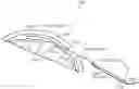 Fig. 01 - Methods and devices for subdural electrode array placement