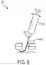 Fig. 08 - Methods and devices for subdural electrode array placement