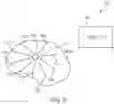 Fig. 11 - Methods and devices for subdural electrode array placement