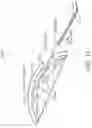 Fig. 15 - Methods and devices for subdural electrode array placement