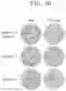 Fig. 11 - CANCER TREATING DEVICE