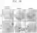 Fig. 13 - CANCER TREATING DEVICE