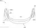 Fig. 01 - Auricular nerve stimulation to address patient disorders, and associated systems and methods