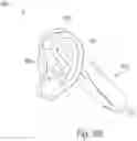 Fig. 10 - Auricular nerve stimulation to address patient disorders, and associated systems and methods