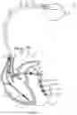 Fig. 02 - Method and system utilizing a percentage-based atrio-ventricular delay adjustment