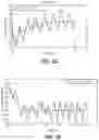 Fig. 03 - Methods and systems for lowering blood pressure through reduction of ventricle filling